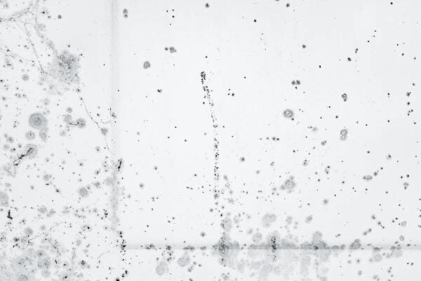 Can Mold Cause Kidney Stones?